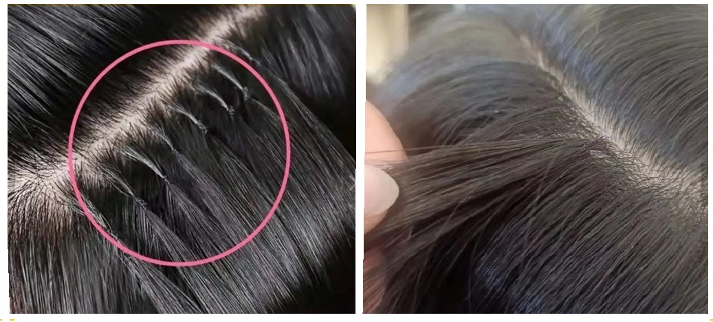 microring extension roma - crivalant